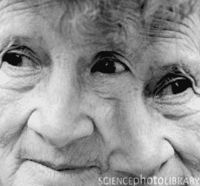 “Mijne kop is kapot»